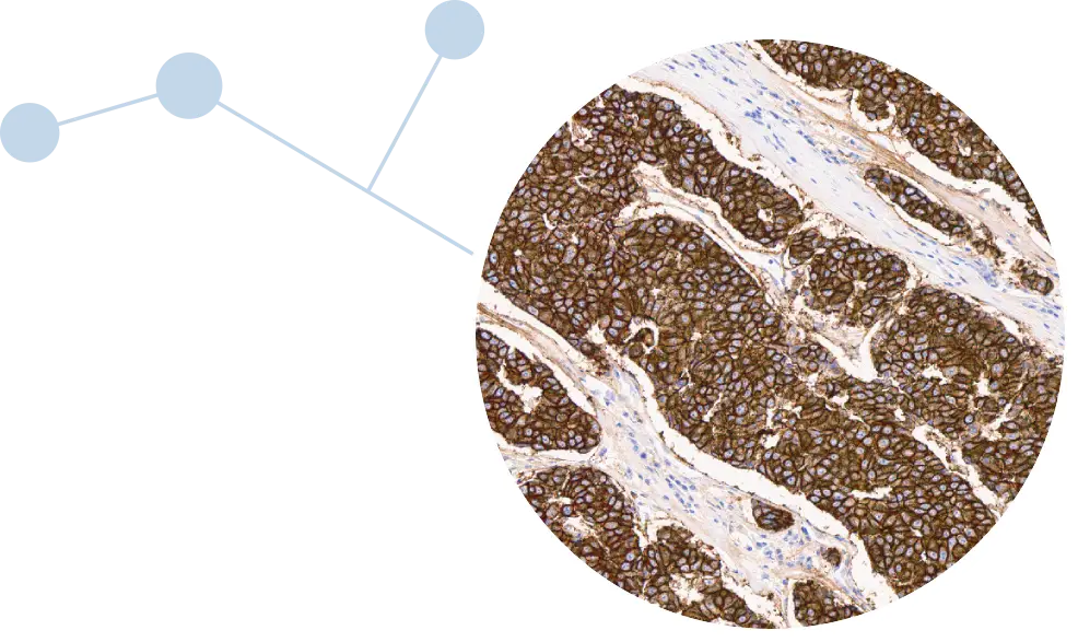 IHC stain