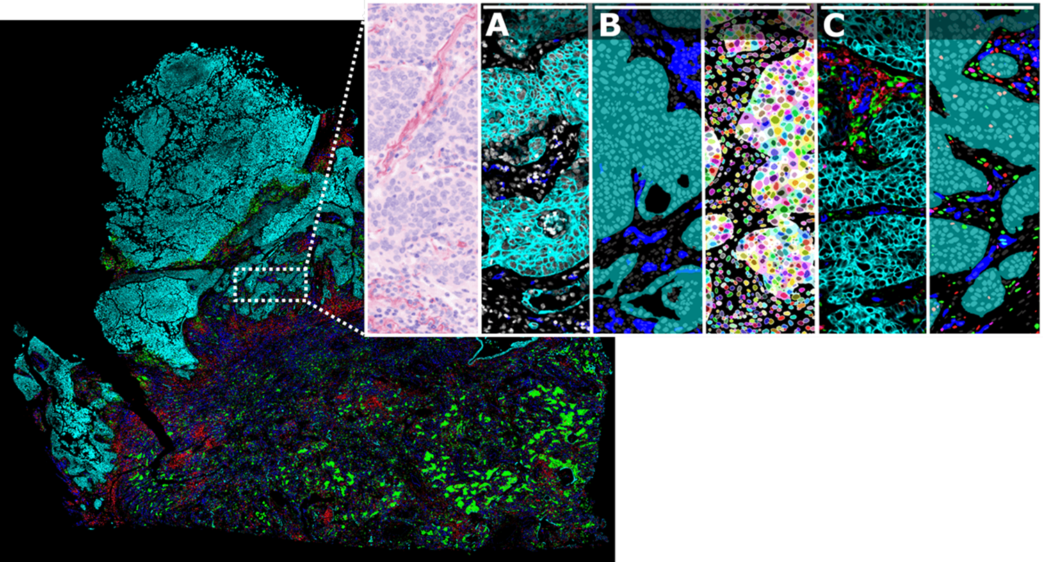 AI-driven image analysis