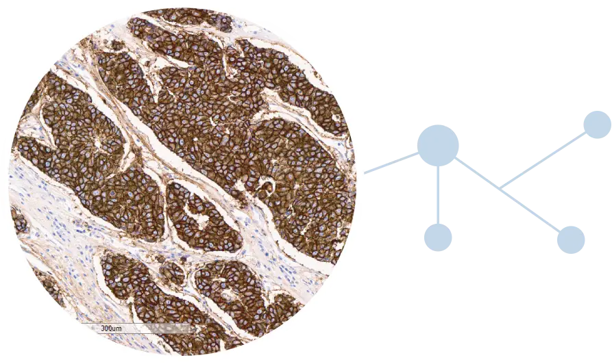 FOLR1 IHC testing