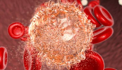 The importance of comprehensive testing in myeloid neoplasms