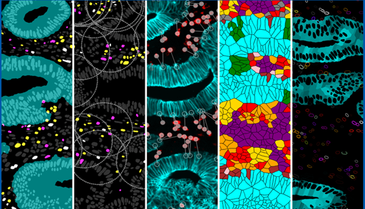 Overcoming the challenges of spatial biology with an innovative AI-driven hyperplexed solution - Paletrra™
